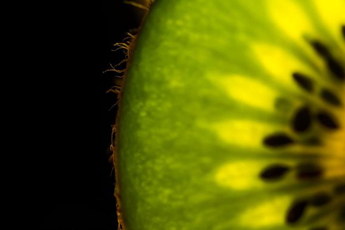 Dr. Pimple Popper Plucks 'Kiwi Hairs' Out of Pores