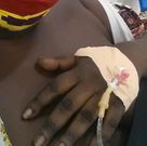 Di Asa contestant allegedly dies of breast-related condition shortly after flaunting them online