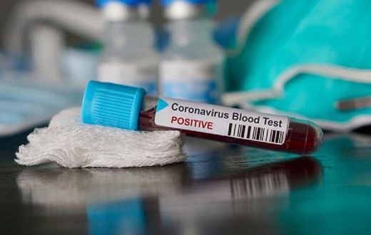 Ghana's COVID-19 cases surge to 7,768