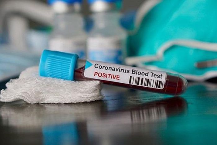 Ghana's COVID-19 cases surge to 7,768