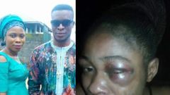 Man beats up wife, inserts hand in her genital to pull out 3-month-old pregnancy she refused to abort