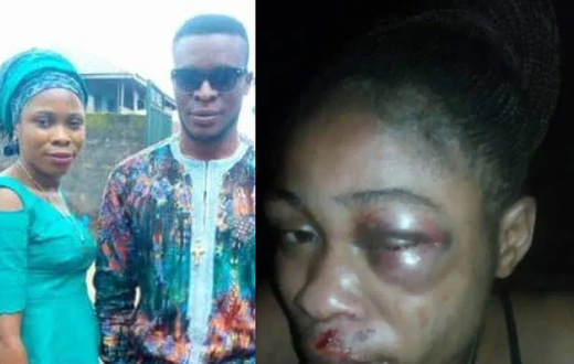 Man beats up wife, inserts hand in her genital to pull out 3-month-old pregnancy she refused to abort