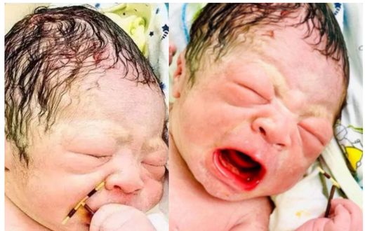 Baby comes out of mother’s womb holding failed family planning device firmly in his hand (photos)