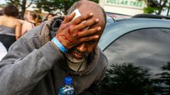 A Somali-American man injured when protesters clashed with police during demonstrations against the death of George Floyd in  Minneapolis on May 27, 2020 -- African refugees have joined the protests against racism