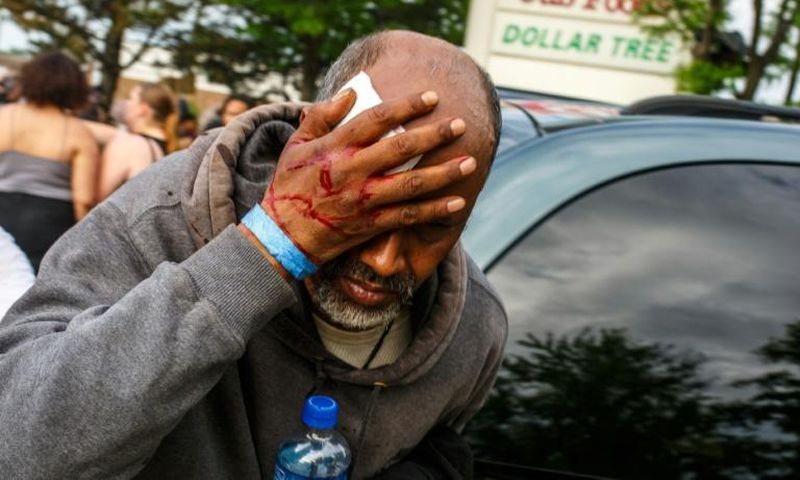 A Somali-American man injured when protesters clashed with police during demonstrations against the death of George Floyd in  Minneapolis on May 27, 2020 -- African refugees have joined the protests against racism