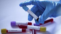 Coronavirus samples