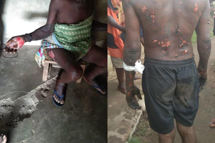 Nigerian governors Special Advisor burns locals because they fought him in his dream (photos)