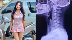 Singer dies after getting a neck twisting massage