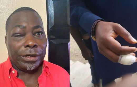 ‘I didn’t bite Mireku Duker’s finger’ – Charles Bissue denies reports