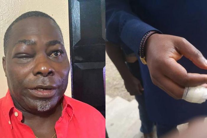 ‘I didn’t bite Mireku Duker’s finger’ – Charles Bissue denies reports