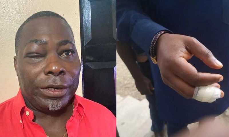 ‘I didn’t bite Mireku Duker’s finger’ – Charles Bissue denies reports