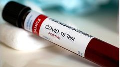 COVID-19: Ghana’s active cases rise above 1,000 again