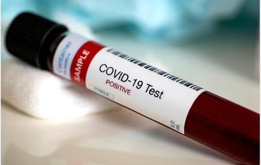 COVID-19: Ghana’s active cases rise above 1,000 again