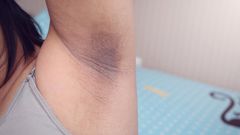 Dark underarm