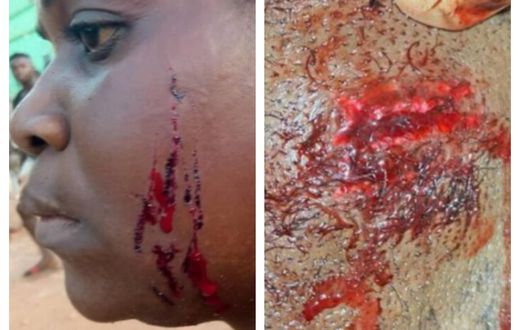 MP's family attacked