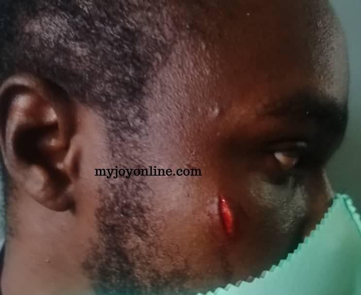 WAEC relocates WASSCE exam centre from Bright SHS to Ofori Panin SHS after riots