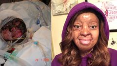 Kechi Okwuchi: "If you’re not dead, God’s not done" - Plane crash survivor recounts her ordeal