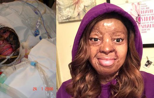 Kechi Okwuchi: "If you’re not dead, God’s not done" - Plane crash survivor recounts her ordeal