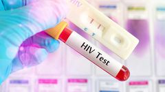 HIV test