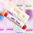 HIV test