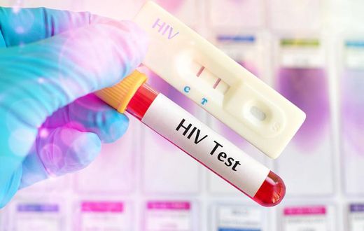 HIV test