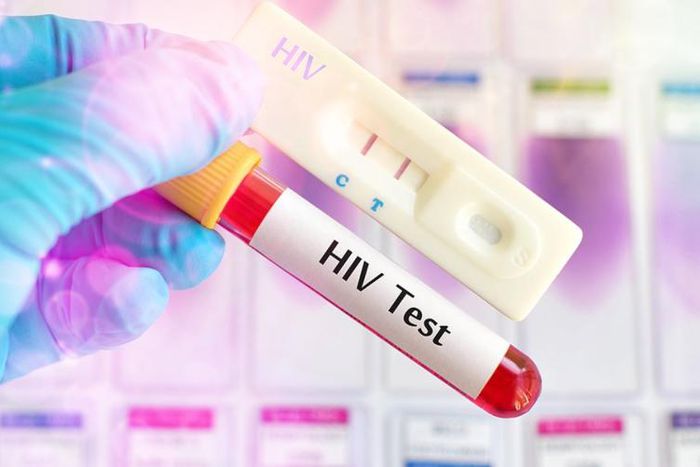 HIV test