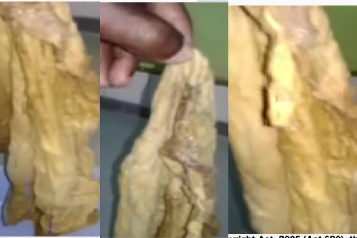 Ridge Hospital again? Doctors leave huge towel in woman’s tummy for 9 months after caesarian section (video)