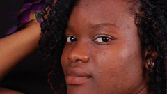 5 natural ways to get rid of acne scars and pimple marks