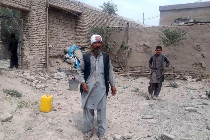 An injured man near the site of the bombing