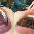 Tattoos in the mouth is the latest craze emerging (photos)