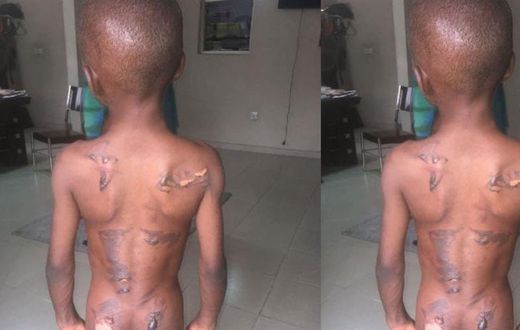 Woman burns 8-year-old nephew with electric iron for eating her groundnut