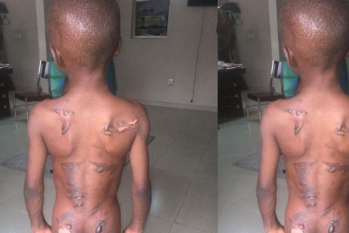 Woman burns 8-year-old nephew with electric iron for eating her groundnut