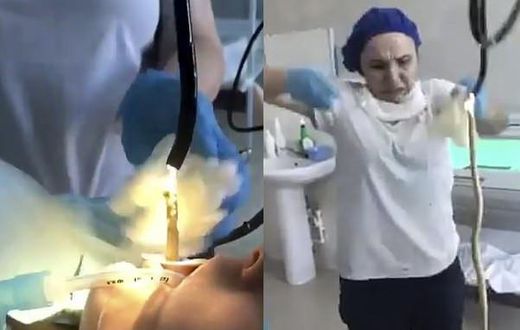 Doctors remove 4feet snake from woman’s throat