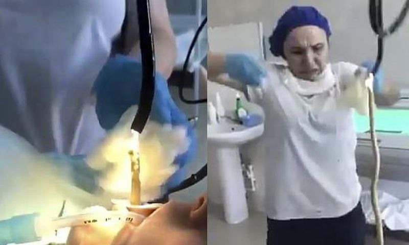Doctors remove 4feet snake from woman’s throat