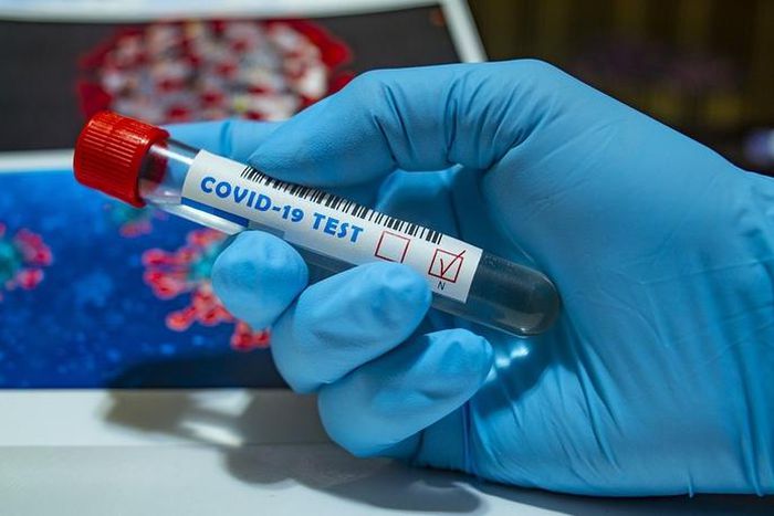 Covid-19 : 27 nouveaux cas dont 15 communautaires, 1 décès, 36 cas graves....