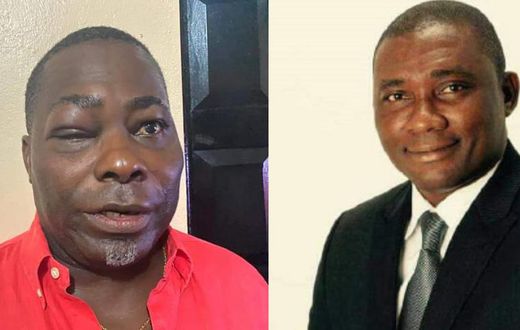 ‘He threw the first blow’ – MP Mireku explains fight with Charles Bissue