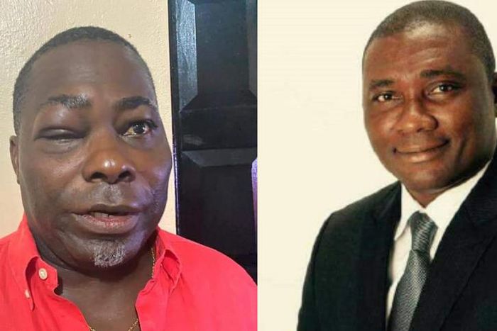 ‘He threw the first blow’ – MP Mireku explains fight with Charles Bissue
