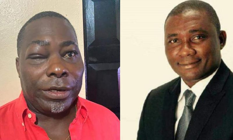 ‘He threw the first blow’ – MP Mireku explains fight with Charles Bissue