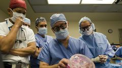 Doctors at the Cleveland Clinic -- (L-R) Dr. Risal Djohan, Dr. Daniel Alam, Dr. Francis Papay and Dr. Maria Siemionow -- completed the operation on Connie Culp in December 2008