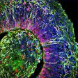 This image shows a cross-section of a brain organoid -- a lab-grown mini brain that can be used to study the effects of a disease