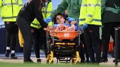 Manchester City manager Pep Guardiola has just 13 senior players to choose from for Sunday's visit of Leicester