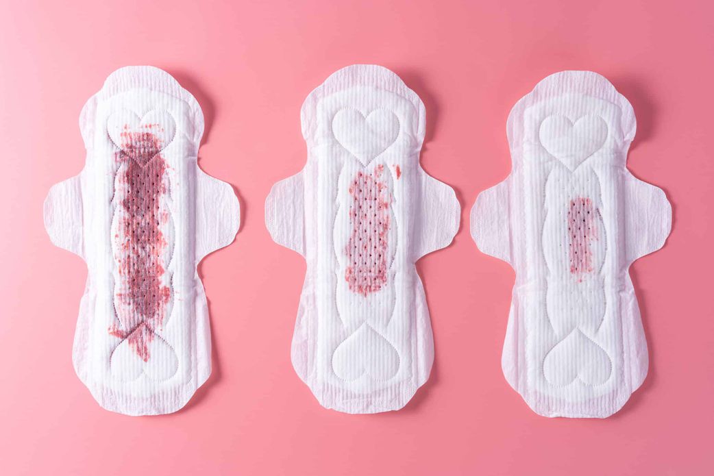 implantation bleeding