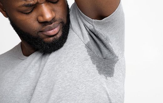 Person having excessive underarm sweating