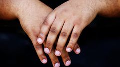 3 home remedies to get rid of dark knuckles