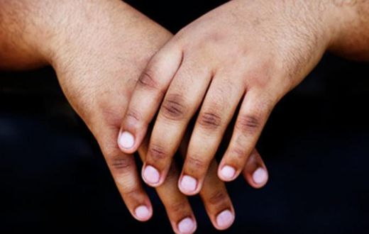 3 home remedies to get rid of dark knuckles