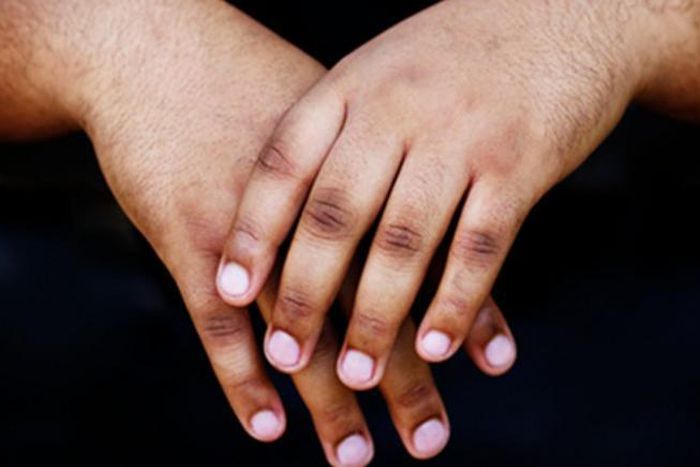 3 home remedies to get rid of dark knuckles