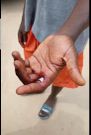 Kasoa boy likely to lose finger after wearing friend's skawa ring; pastors & doctors can’t help