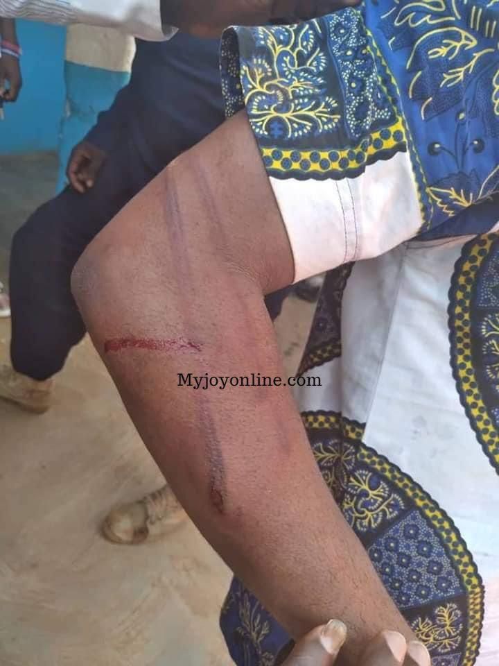 NPP’s Communications team member given 40 lashes (Credit: Myjoyonline)