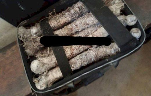 Human bones