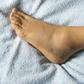 Swollen foot